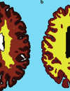 Study Reveals How Being Overweight Effects Your Brain